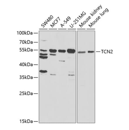Western Blot - Anti-TC-2 Antibody (A11873) - Antibodies.com