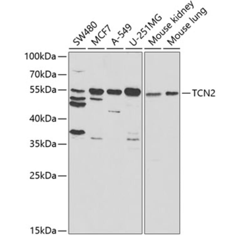 Western Blot - Anti-TC-2 Antibody (A11873) - Antibodies.com