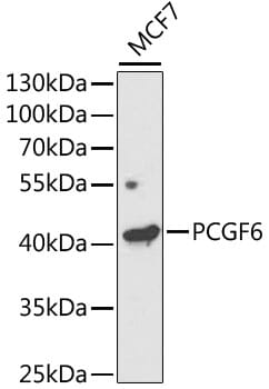 Western blot analysis of extracts of MCF7 cells, using Anti-PCGF6 Antibody (A5760) at 1:1,000 dilution.
Secondary antibody: Goat Anti-Rabbit IgG (H+L) (HRP) (AS014) at 1:10,000 dilution.
Lysates / proteins: 25µg per lane.
Blocking buffer: 3% non-fat dry milk in TBST.
Detection: ECL Enhanced Kit (RM00021).
Exposure time: 120s.