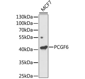 Western Blot - Anti-PCGF6 Antibody (A11874) - Antibodies.com