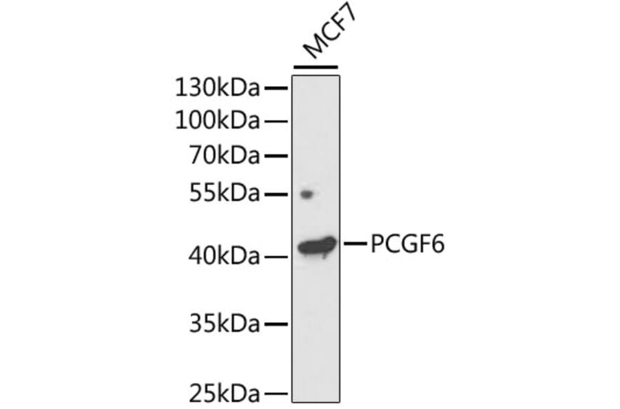 Western Blot - Anti-PCGF6 Antibody (A11874) - Antibodies.com