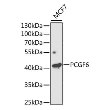 Western Blot - Anti-PCGF6 Antibody (A11874) - Antibodies.com