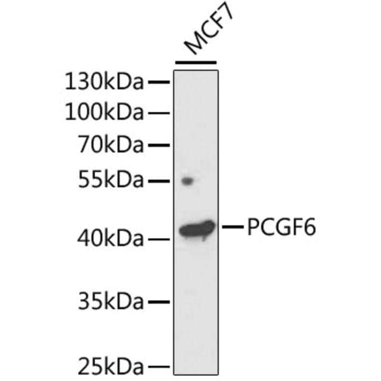 Western Blot - Anti-PCGF6 Antibody (A11874) - Antibodies.com