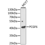 Western Blot - Anti-PCGF6 Antibody (A11874) - Antibodies.com