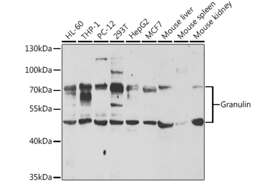 Western Blot - Anti-Granulin Antibody (A11875) - Antibodies.com