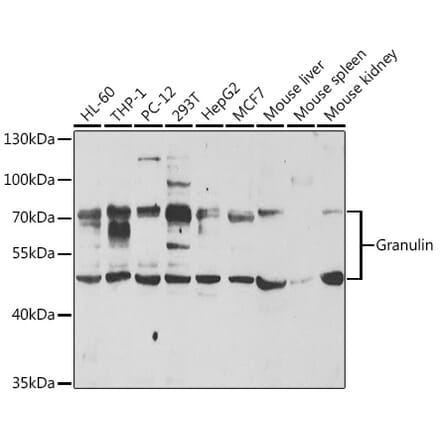 Western Blot - Anti-Granulin Antibody (A11875) - Antibodies.com