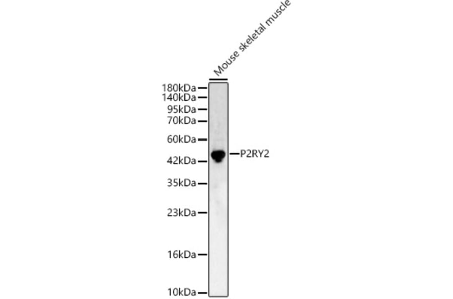 Western Blot - Anti-P2Y2 Antibody (A11876) - Antibodies.com