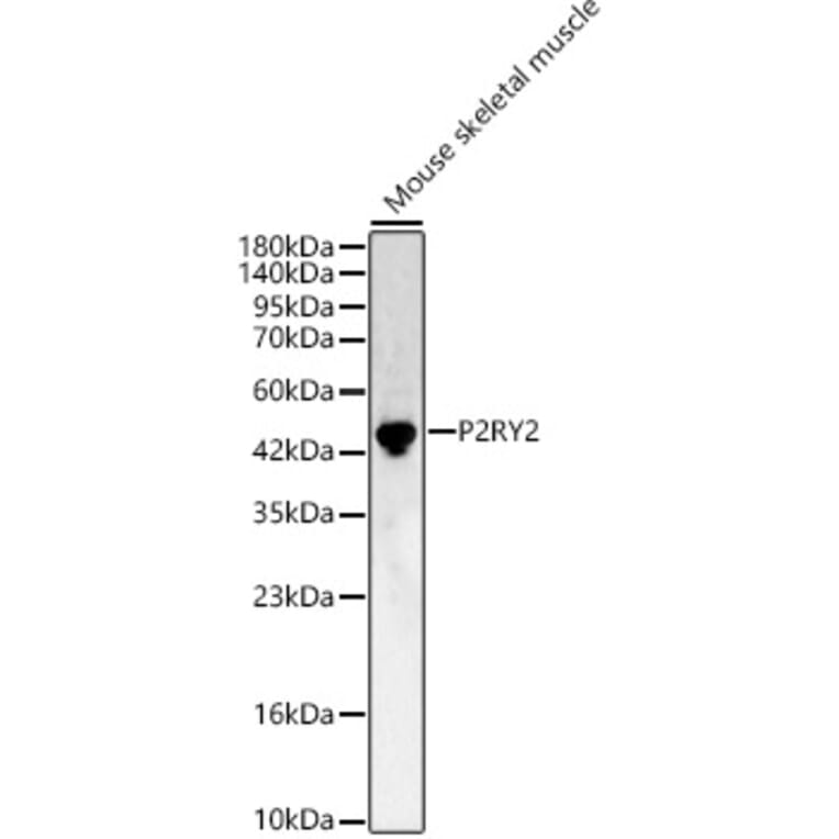 Western Blot - Anti-P2Y2 Antibody (A11876) - Antibodies.com