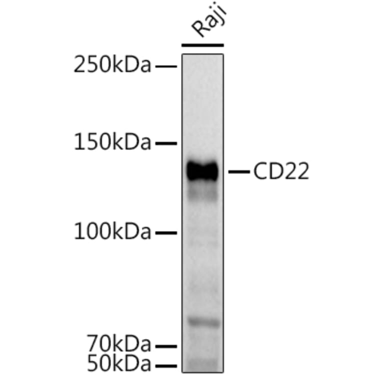 Western Blot - Anti-CD22 Antibody (A11877) - Antibodies.com