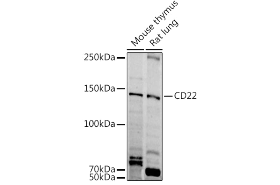 Western Blot - Anti-CD22 Antibody (A11877) - Antibodies.com
