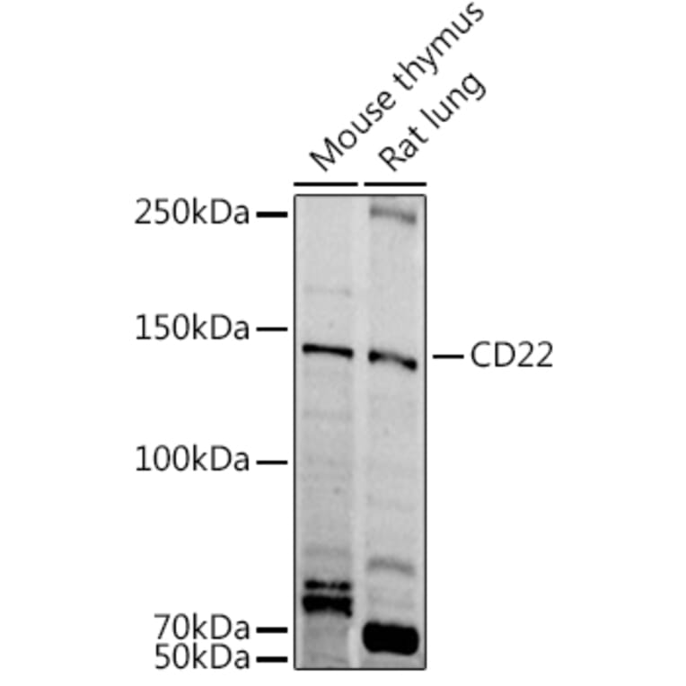 Western Blot - Anti-CD22 Antibody (A11877) - Antibodies.com
