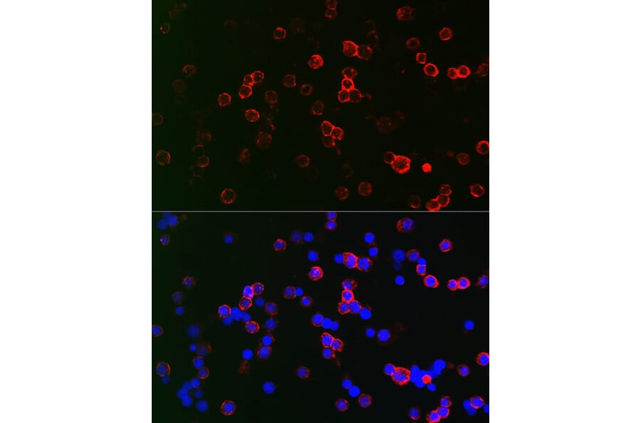 Immunofluorescence - Anti-CD22 Antibody (A11877) - Antibodies.com