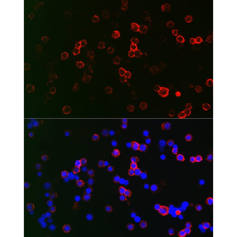 Immunofluorescence - Anti-CD22 Antibody (A11877) - Antibodies.com