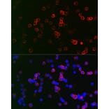 Immunofluorescence - Anti-CD22 Antibody (A11877) - Antibodies.com