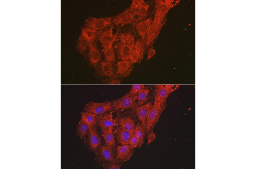 Immunofluorescence - Anti-CXCL1/GRO alpha Antibody (A11879) - Antibodies.com