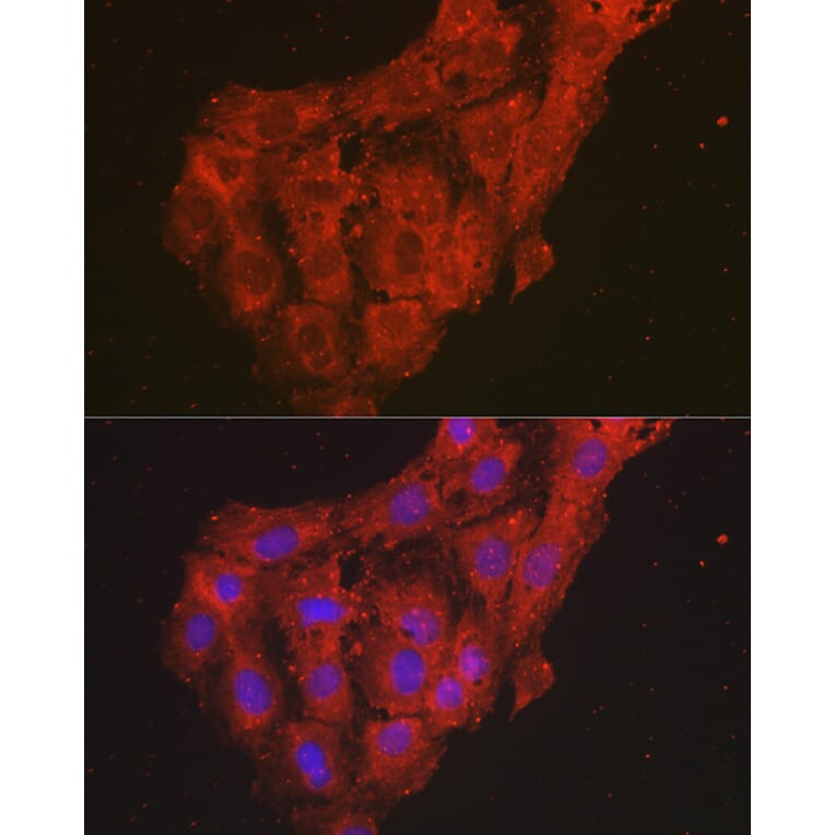 Immunofluorescence - Anti-CXCL1/GRO alpha Antibody (A11879) - Antibodies.com