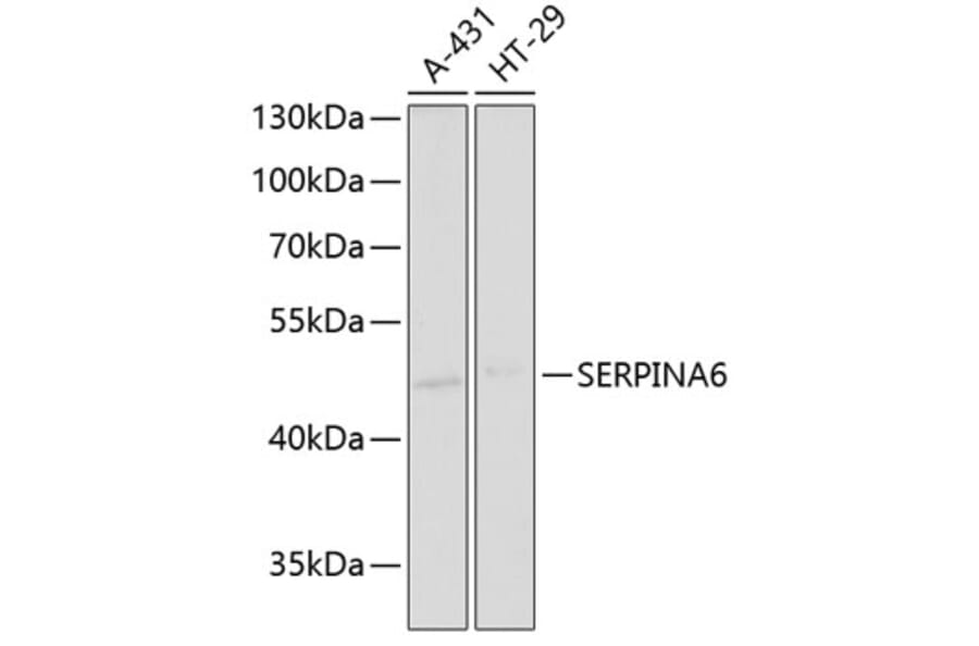 Western Blot - Anti-Cortisol Binding Globulin Antibody (A11880) - Antibodies.com