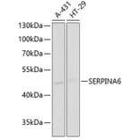 Western Blot - Anti-Cortisol Binding Globulin Antibody (A11880) - Antibodies.com