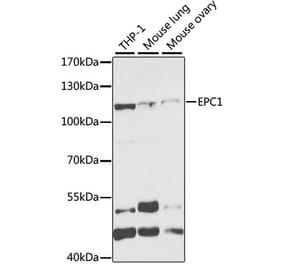 Western Blot - Anti-EPC1 Antibody (A11881) - Antibodies.com