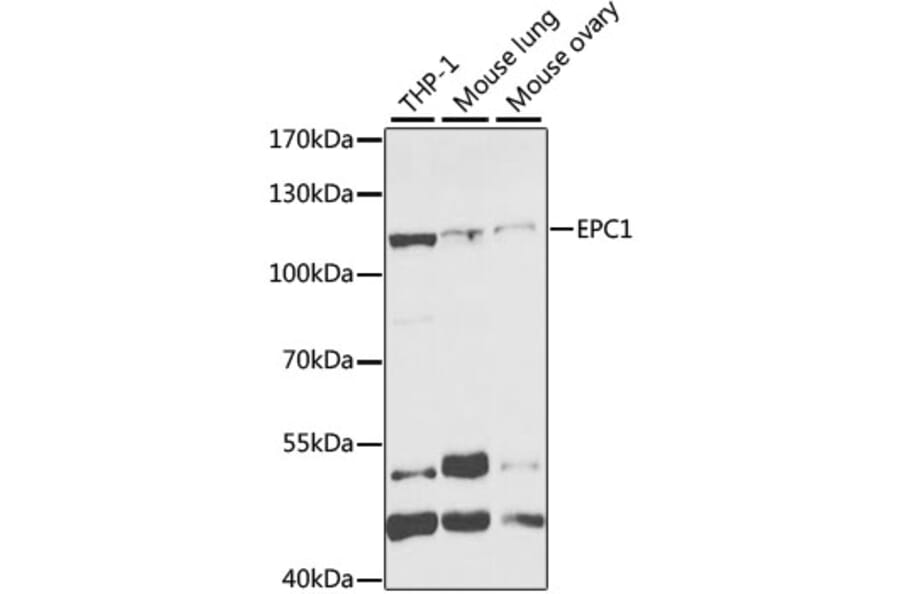 Western Blot - Anti-EPC1 Antibody (A11881) - Antibodies.com