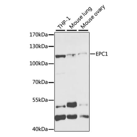 Western Blot - Anti-EPC1 Antibody (A11881) - Antibodies.com