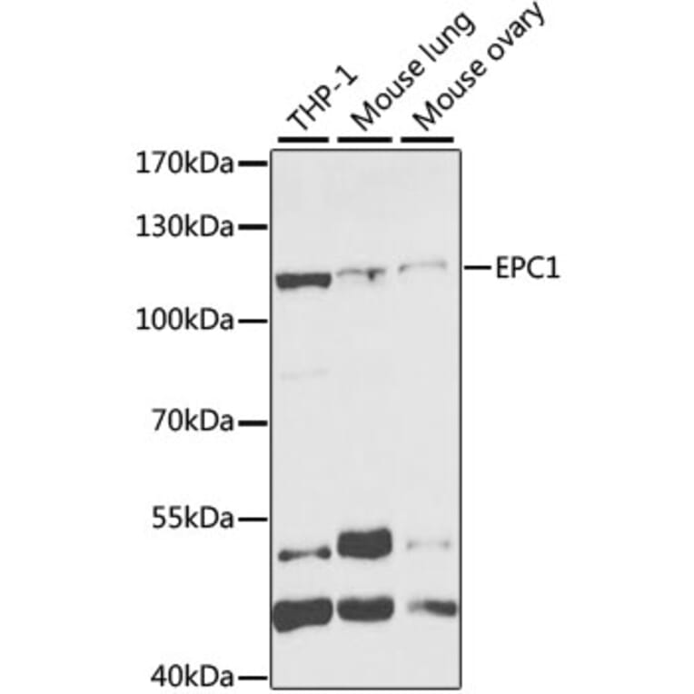 Western Blot - Anti-EPC1 Antibody (A11881) - Antibodies.com