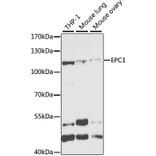 Western Blot - Anti-EPC1 Antibody (A11881) - Antibodies.com