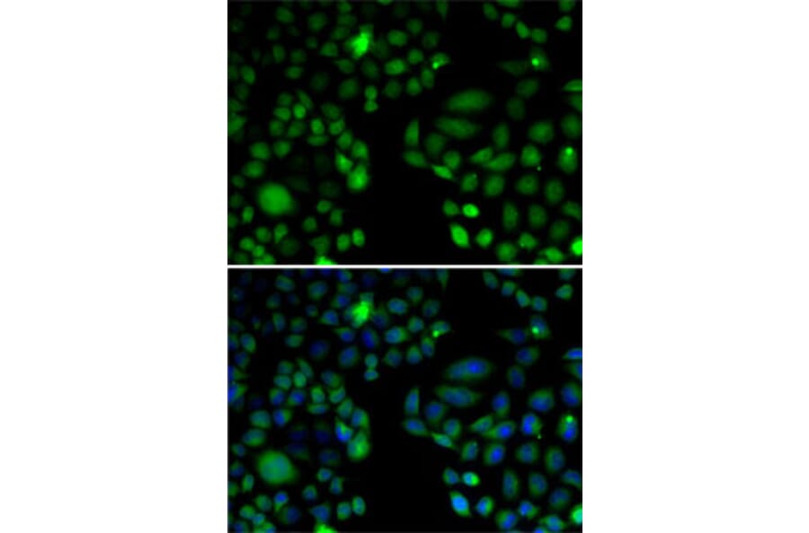 Immunofluorescence - Anti-EPC1 Antibody (A11881) - Antibodies.com