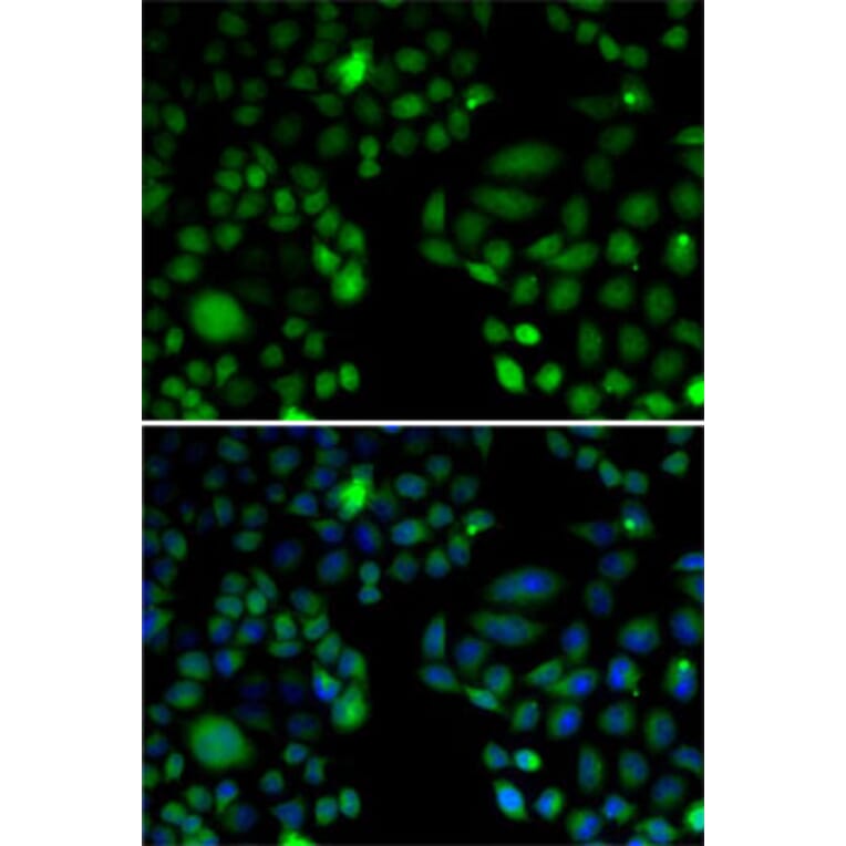 Immunofluorescence - Anti-EPC1 Antibody (A11881) - Antibodies.com