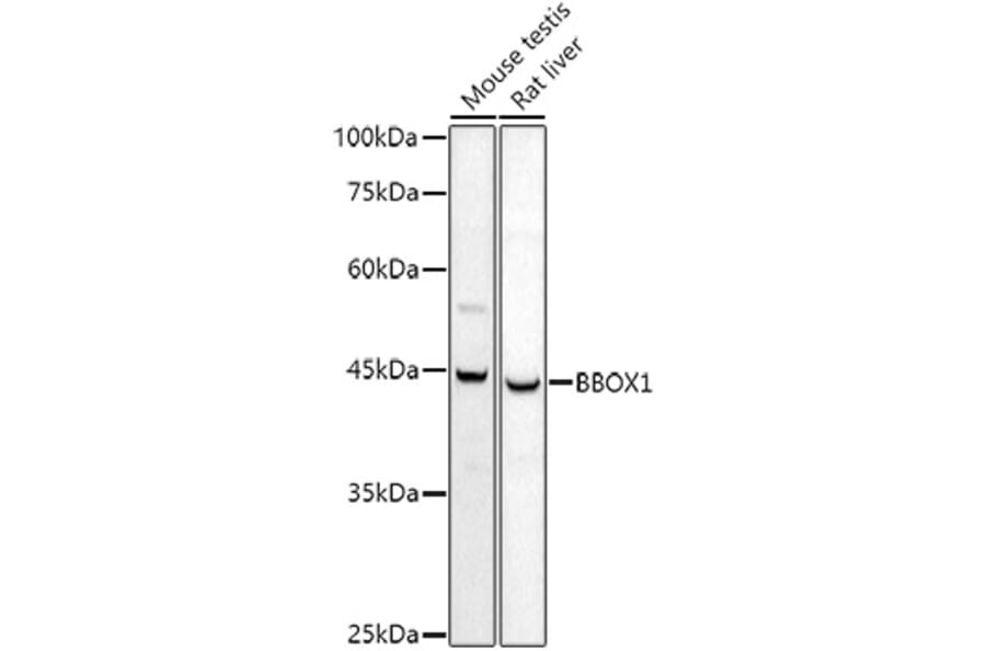 Western Blot - Anti-BBOX1 Antibody (A11882) - Antibodies.com