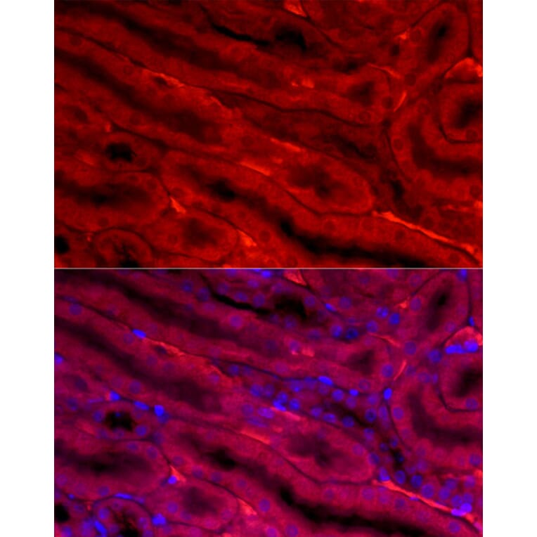 Immunofluorescence - Anti-BBOX1 Antibody (A11882) - Antibodies.com