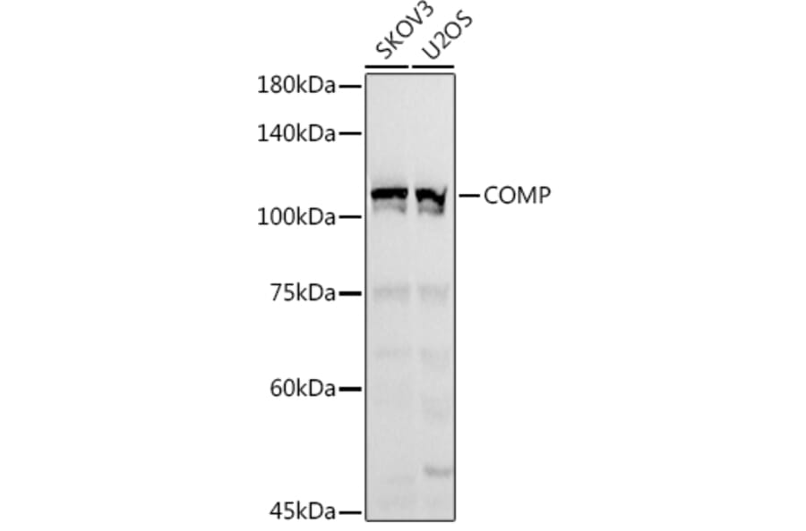 Western Blot - Anti-COMP/Cartilage oligomeric matrix protein Antibody (A11883) - Antibodies.com