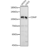 Western Blot - Anti-COMP/Cartilage oligomeric matrix protein Antibody (A11883) - Antibodies.com