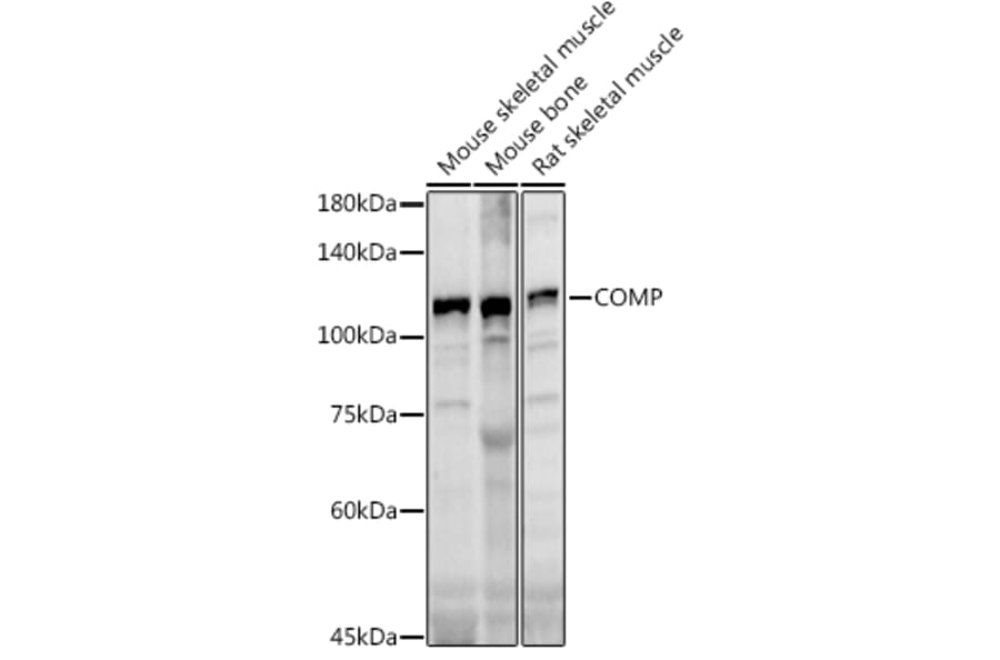 Western Blot - Anti-COMP/Cartilage oligomeric matrix protein Antibody (A11883) - Antibodies.com