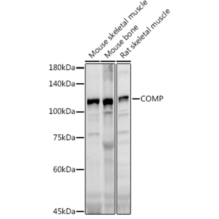 Western Blot - Anti-COMP/Cartilage oligomeric matrix protein Antibody (A11883) - Antibodies.com