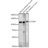 Western Blot - Anti-COMP/Cartilage oligomeric matrix protein Antibody (A11883) - Antibodies.com