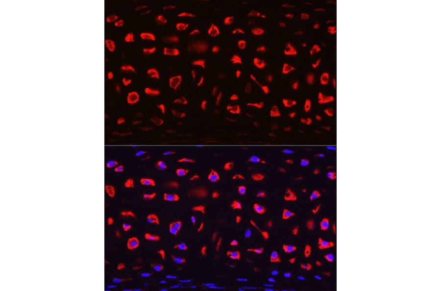 Immunofluorescence - Anti-COMP/Cartilage oligomeric matrix protein Antibody (A11883) - Antibodies.com
