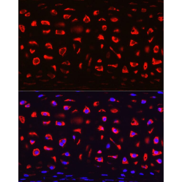 Immunofluorescence - Anti-COMP/Cartilage oligomeric matrix protein Antibody (A11883) - Antibodies.com