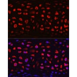 Immunofluorescence - Anti-COMP/Cartilage oligomeric matrix protein Antibody (A11883) - Antibodies.com