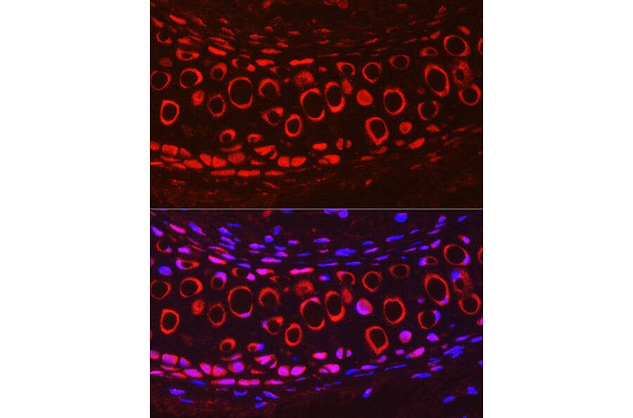 Immunofluorescence - Anti-COMP/Cartilage oligomeric matrix protein Antibody (A11883) - Antibodies.com