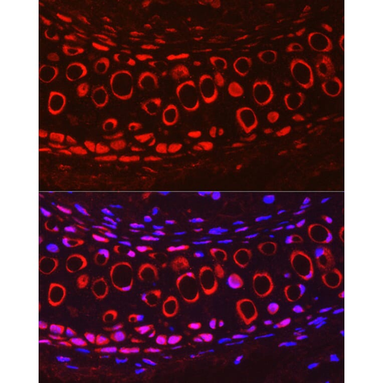 Immunofluorescence - Anti-COMP/Cartilage oligomeric matrix protein Antibody (A11883) - Antibodies.com