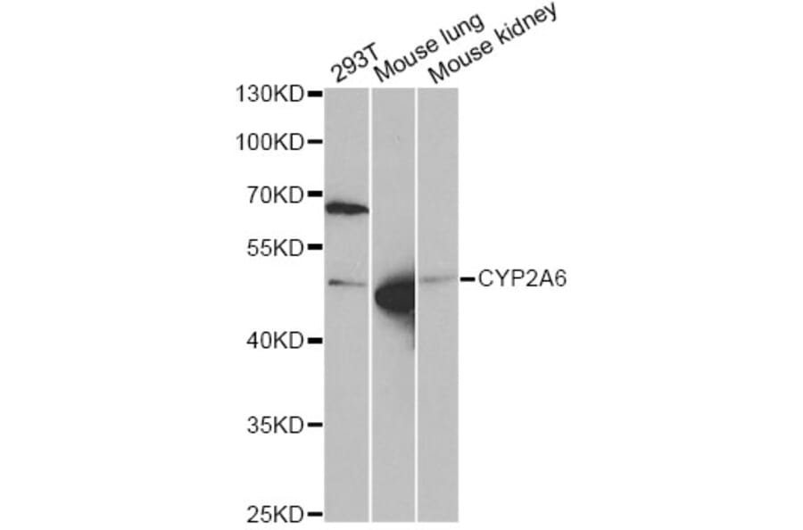 Western Blot - Anti-CYP2A6 Antibody (A5815) - Antibodies.com