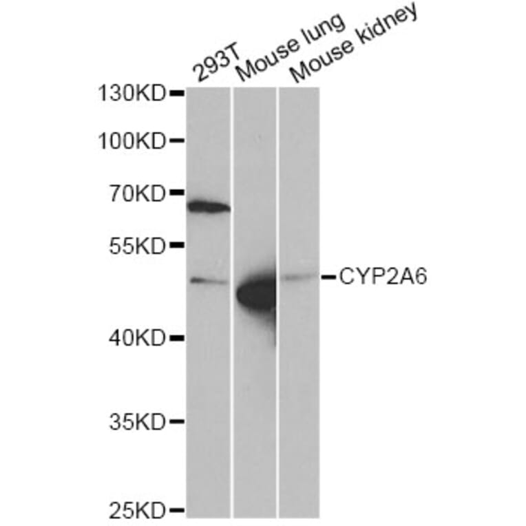 Western Blot - Anti-CYP2A6 Antibody (A5815) - Antibodies.com