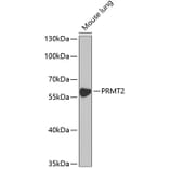 Western Blot - Anti-PRMT2/HMT1 Antibody (A11885) - Antibodies.com
