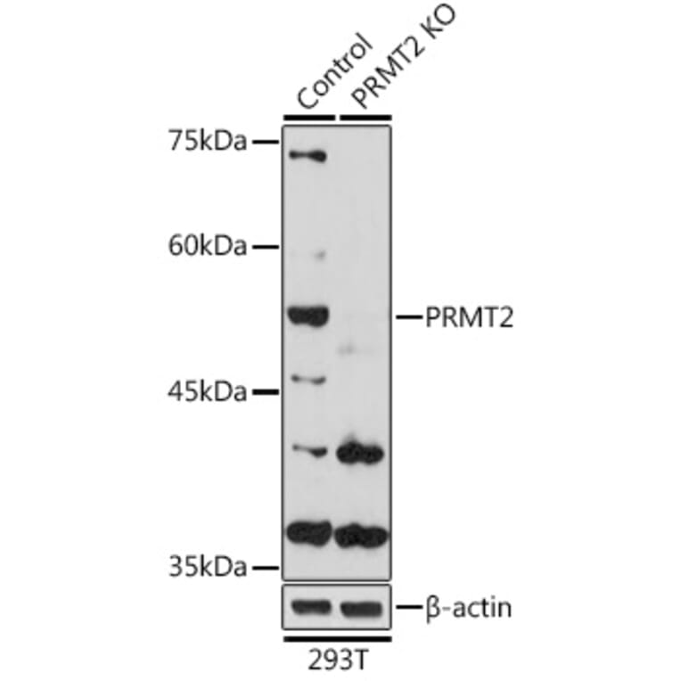 Western Blot - Anti-PRMT2/HMT1 Antibody (A11885) - Antibodies.com
