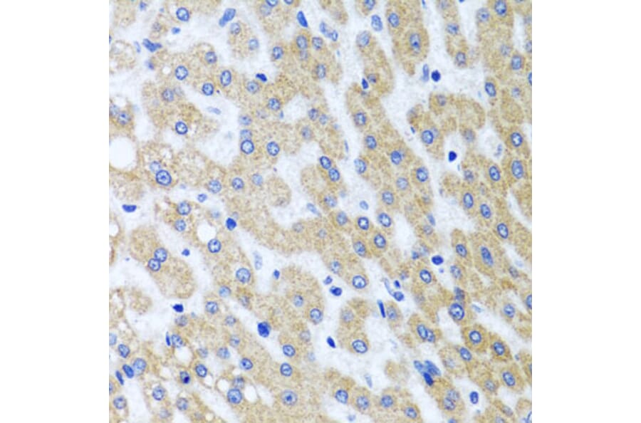 Immunohistochemistry - Anti-PRMT2/HMT1 Antibody (A11885) - Antibodies.com