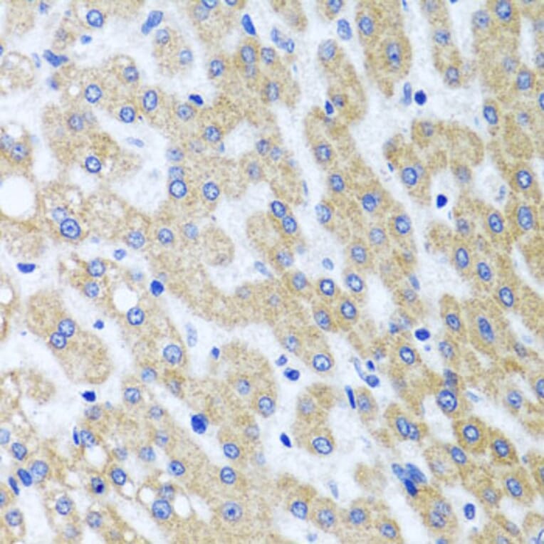 Immunohistochemistry - Anti-PRMT2/HMT1 Antibody (A11885) - Antibodies.com