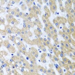 Immunohistochemistry - Anti-PRMT2/HMT1 Antibody (A11885) - Antibodies.com