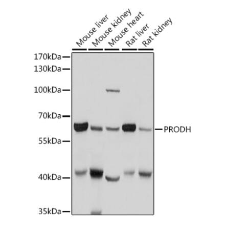 Western Blot - Anti-PRODH Antibody (A11886) - Antibodies.com