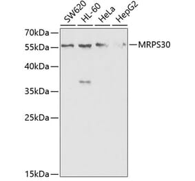 Western Blot - Anti-MRPS30 Antibody (A11887) - Antibodies.com